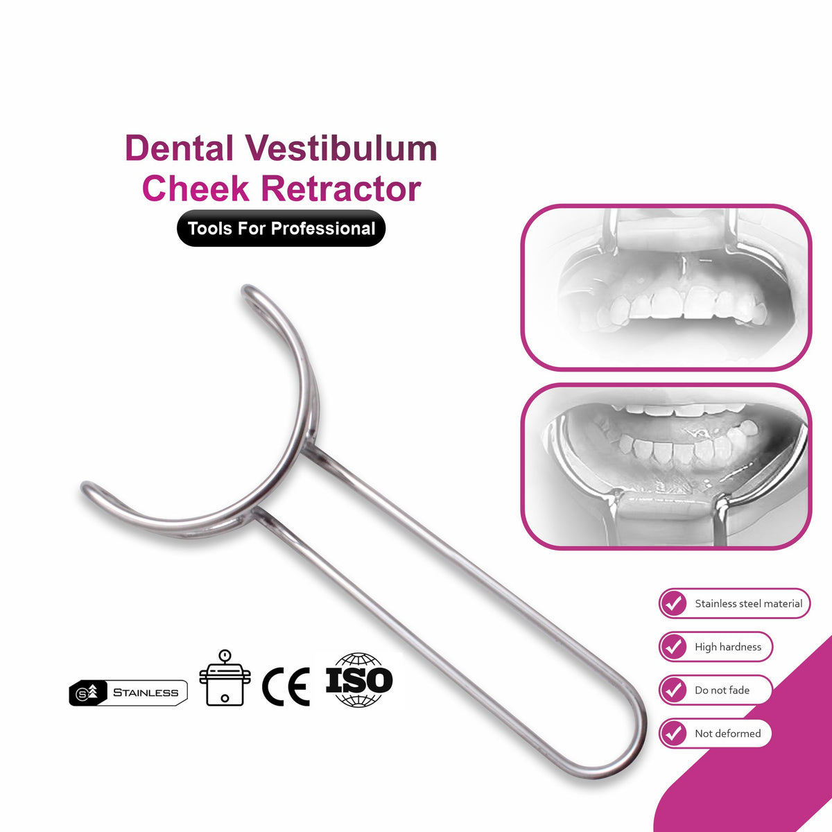 Dental Vestibulum Cheek Retractor